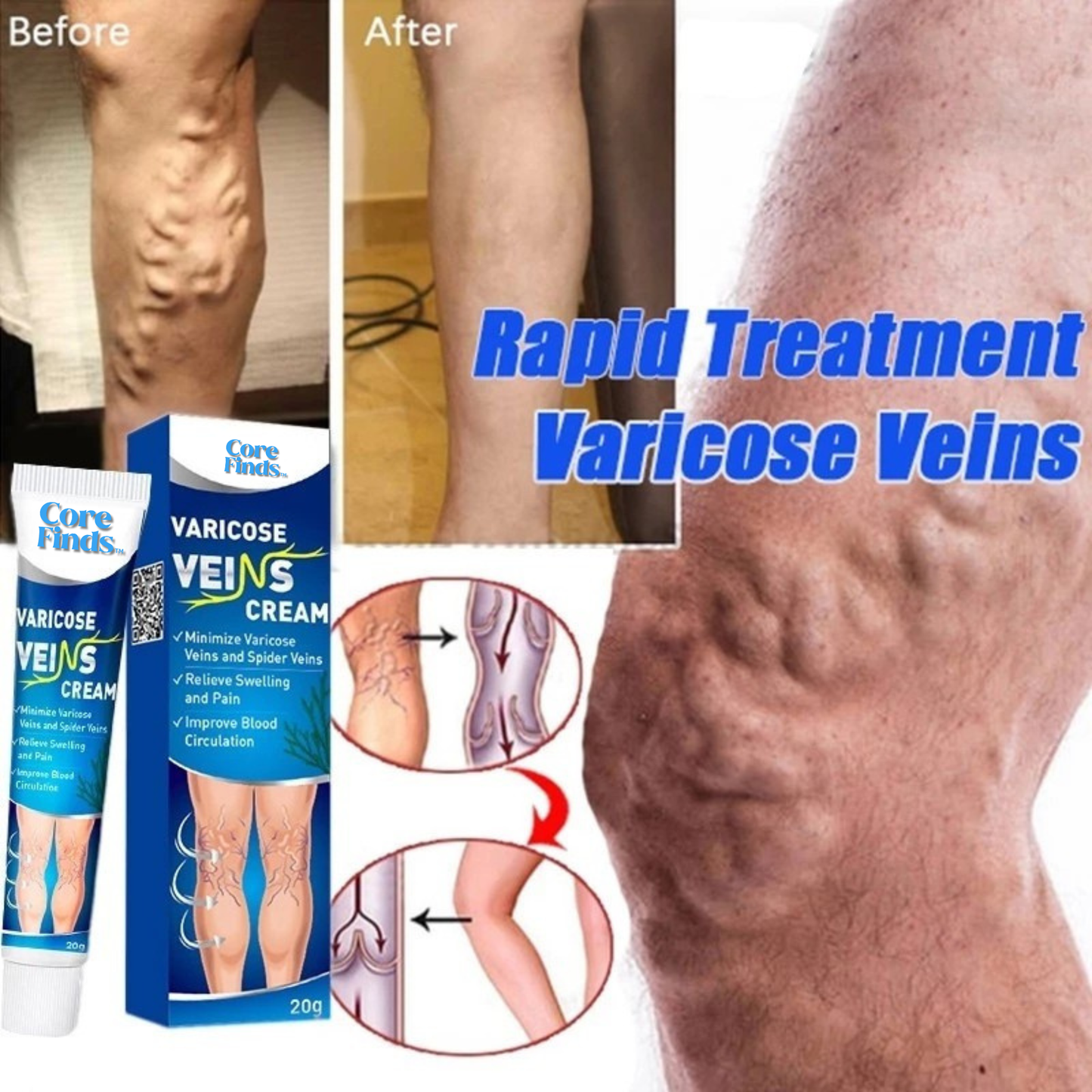 𝐕𝐞𝐢𝐧𝐄𝐚𝐬𝐞™ Varicose Vein Treatment Cream Leg