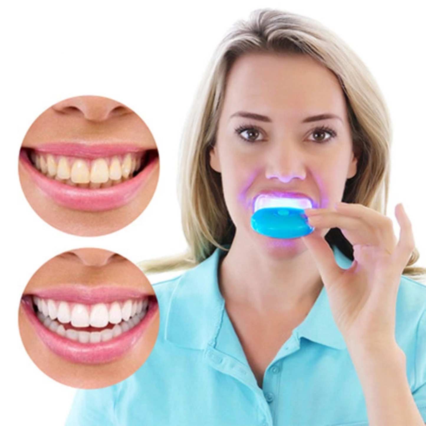 𝗕𝗿𝗶𝗹𝗹𝗶𝘁𝗲™ Teeth Whitening Light