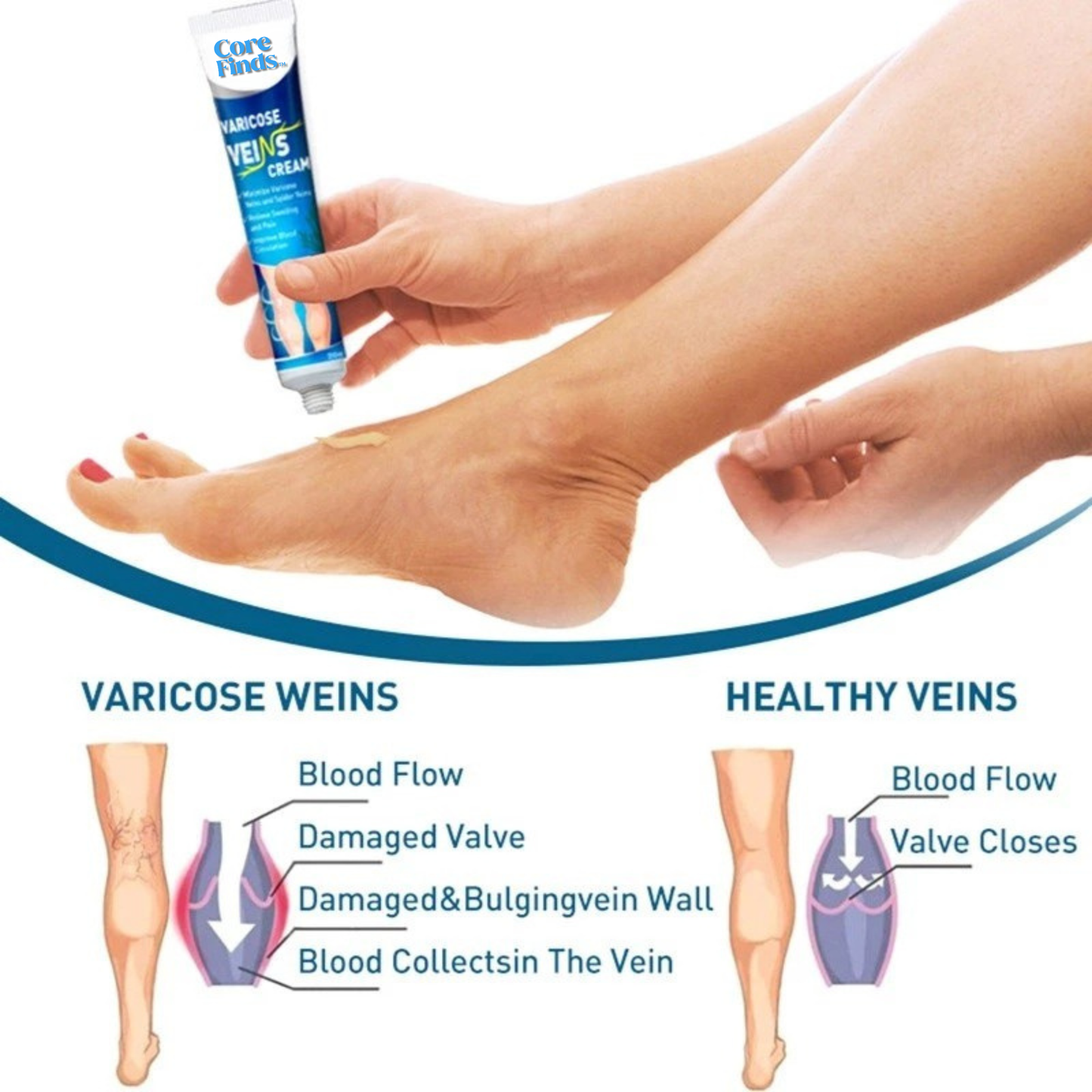 𝐕𝐞𝐢𝐧𝐄𝐚𝐬𝐞™ Varicose Vein Treatment Cream Leg