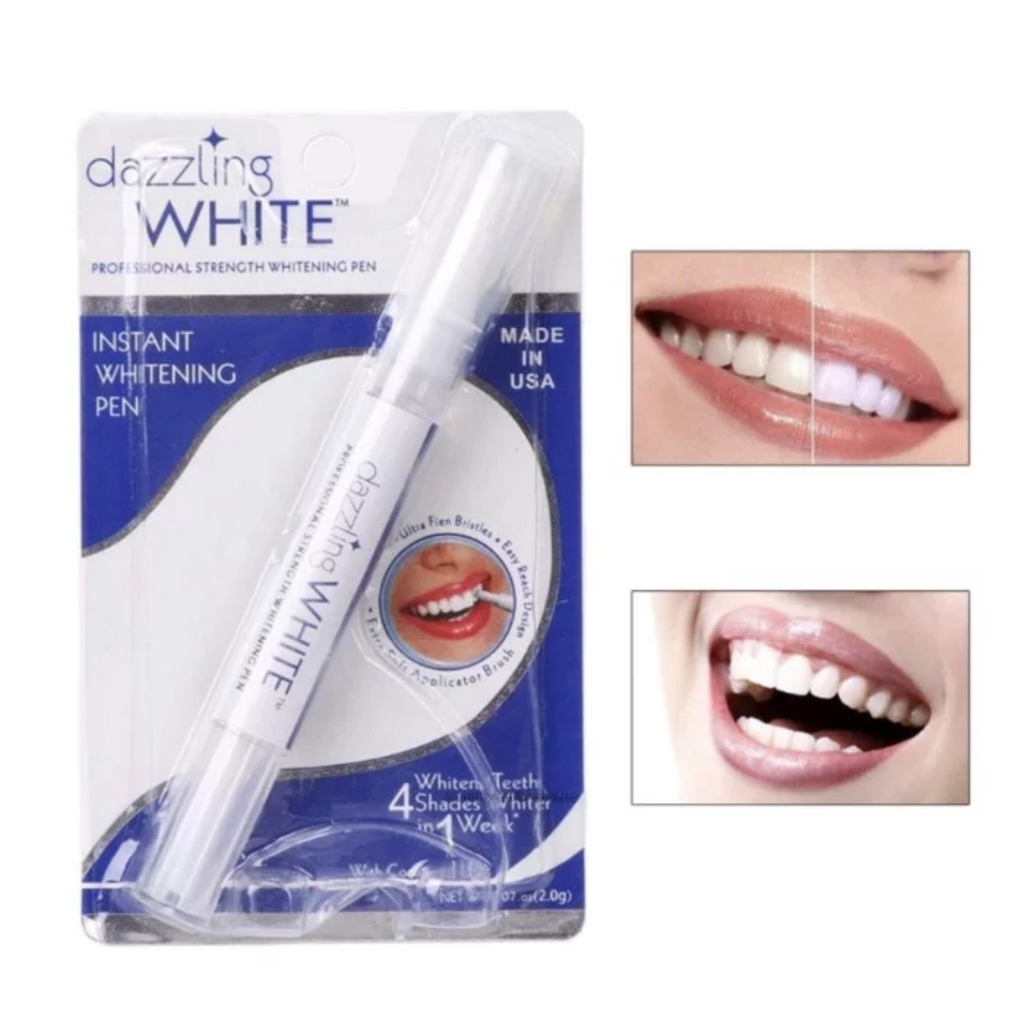 𝐒𝐩𝐚𝐫𝐤𝐥𝐢𝐧𝐠™ Teeth Whitening Pen