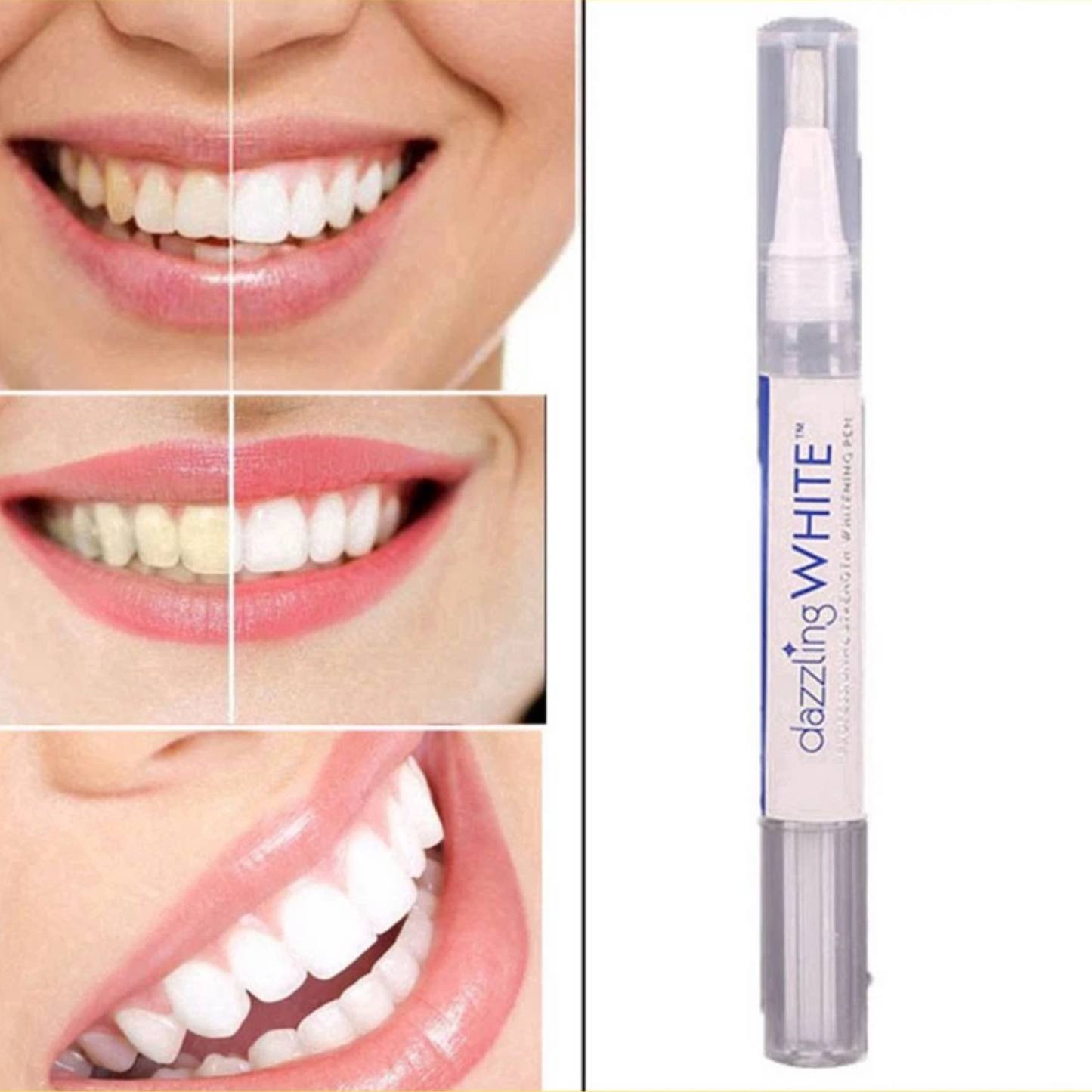 𝐒𝐩𝐚𝐫𝐤𝐥𝐢𝐧𝐠™ Teeth Whitening Pen
