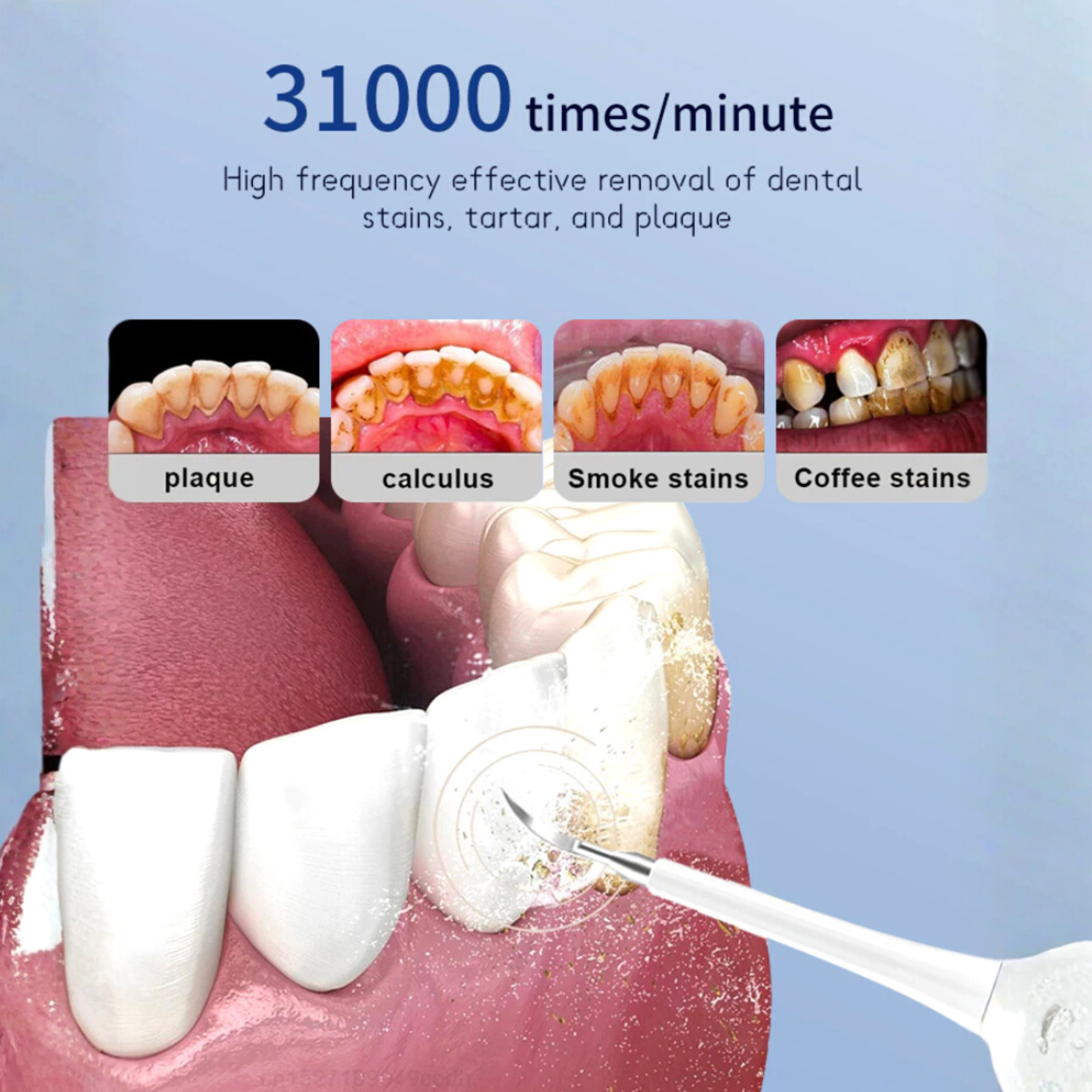 𝐃𝐞𝐧𝐭𝐢𝐪𝐮𝐞™ 6 in 1 Portable Electric Toothbrush